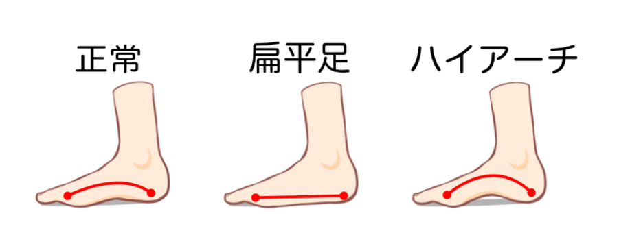 足の裏の形